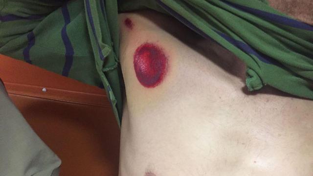 Police fired rubber bullets at rioters (Photo: Hilal Badir)