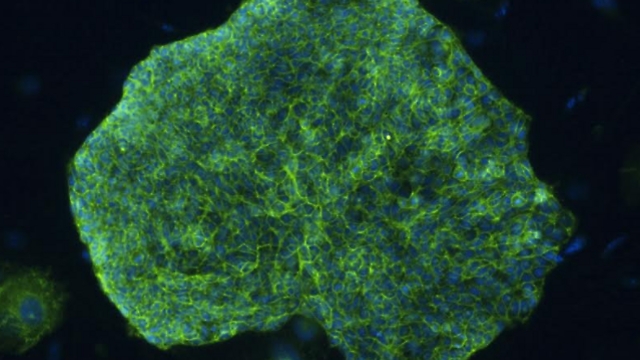 Benchetrit et al., Cell stem cell, 2015 ()