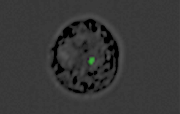 תא המונוציט אשר הפך לפיתיון. הנקודה הירוקה – המטען הגנטי שנשלח בתוך בועית מטפיל המלריה לתאי המערכת החיסונית (צילום: מתוך המחקר)