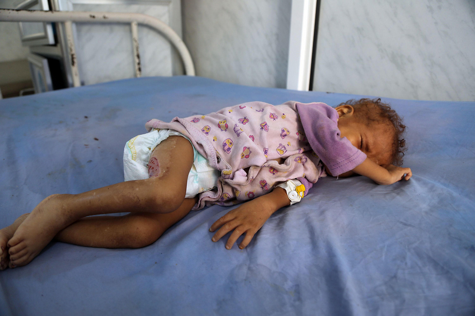 Ребенок к Йемене. Фото: AFP