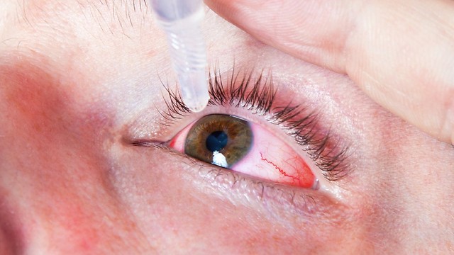 תופעה שעשרות אלפים בישראל סובלים ממנה. יובש בעיניים (צילום: shutterstock) (צילום: shutterstock)