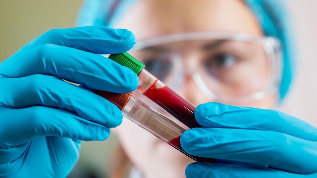 בדיקת דם פשוטה שתזהה את התאים הממאירים (צילום: shutterstock) (צילום: shutterstock)