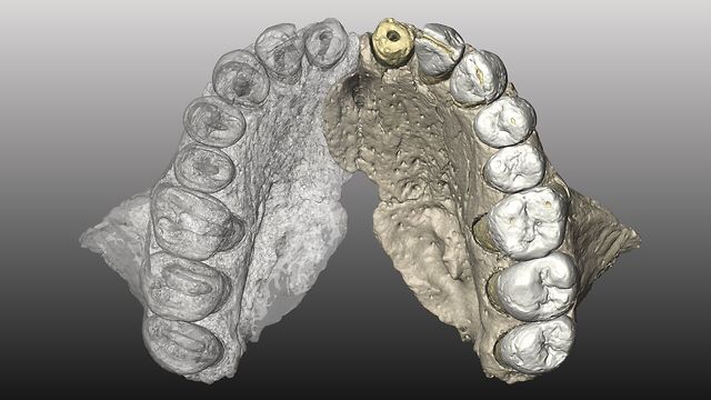 מבט על קשת השיניים (החלק השמאלי הוא המקור החלק הימני משוחזר). כול השיניים למעט החותכת המרכזית נמצאות. הקשת קטנה ופרבולית והמורפולוגיה של השיניים מודרנית (צילום: גרהארד וובר, האוניברסיטה של וינה) (צילום: גרהארד וובר, האוניברסיטה של וינה)