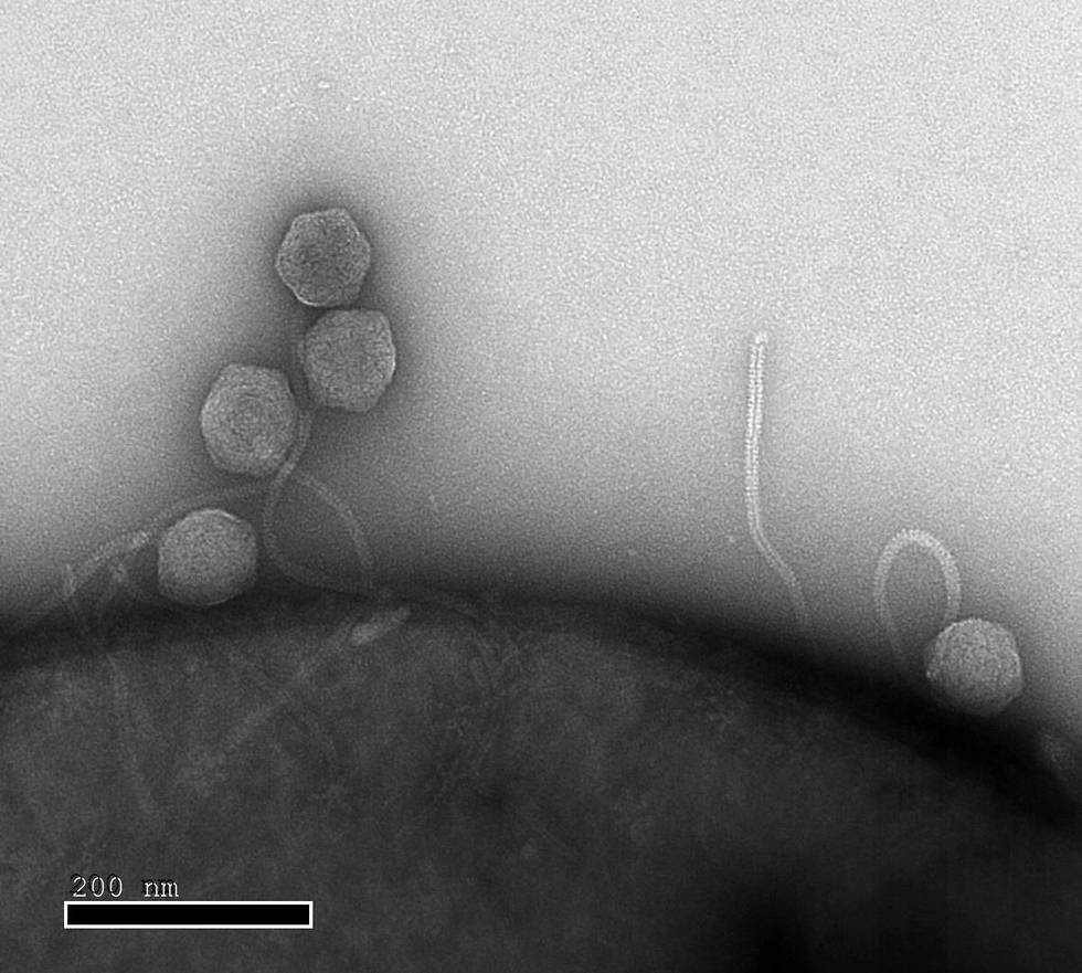 מבט מקרוב: נגיפים פולשים לתא של חיידק אי-קולי (צילום: מסע הקסם המדעי, מכון ויצמן) (צילום: מסע הקסם המדעי, מכון ויצמן)