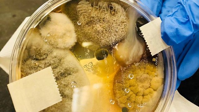 צלחת החיידקים שהחוקרת גידלה. "אתם הולכים להשתגע מהממצאים" צילום: מתוך הפייסבוק של ניקול וורד ( ) ( )