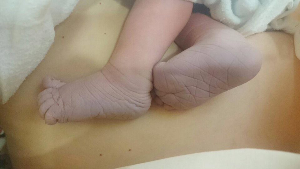 Пяточки новорожденного. Фото с Facebook страницы Лилии Шапиро