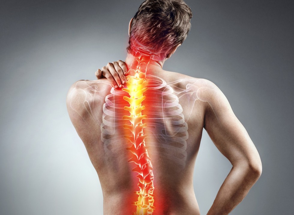 כאבי גב הנגרמים מלחץ עצבי בעמוד השדרה. עקמת  (צילום: shutterstock) (צילום: shutterstock)