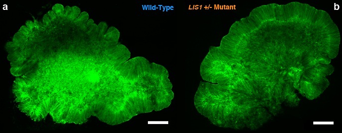 סוד המוח המתקפל. אורגנואיד מוח רגיל (משמאל) ואורגנואיד "מוח חלק" (מימין) (צילום: מכון ויצמן למדע)