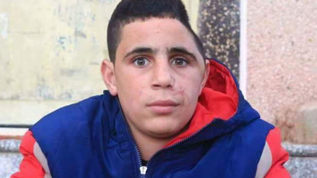 The Tamimi family and the IDF battled over the circumstances leading to Mohammad Tamimi's injuries