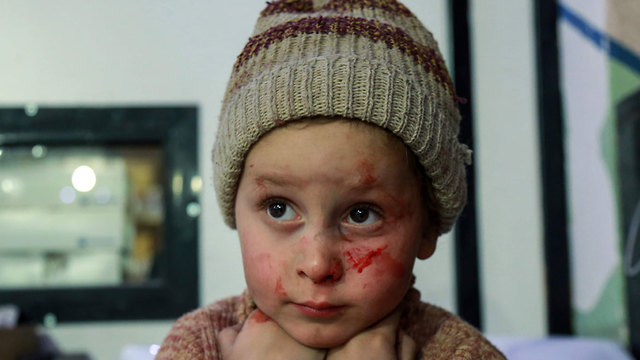 ילדים סורים שנפצעו במזרח רוטה (צילום: AFP) (צילום: AFP)