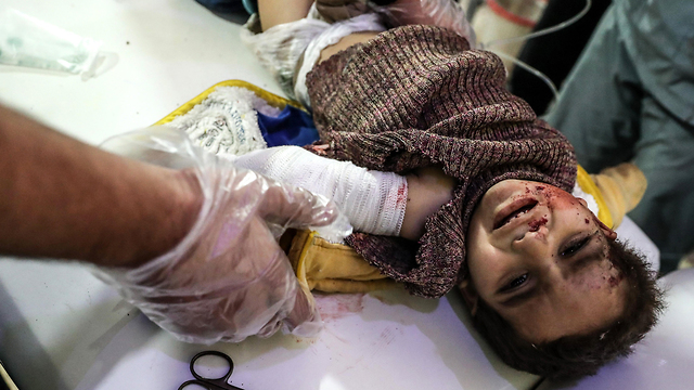 ילד שנפצע במזרח רוטה שבפרברי דמשק (צילום: EPA) (צילום: EPA)