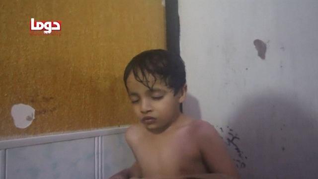 ילדים לאחר תקיפה כימית בסוריה ()