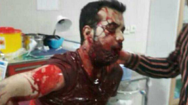 Избитый участник демонстрации протеста в Иране
