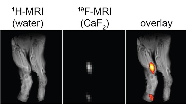 שימוש בסידן פלואורי בתור חומר סימון מאפשר לגלות סימני דלקת שאינם נראים בסריקות MRI רגילות (צילום: מסע הקסם המדעי, מכון ויצמן)