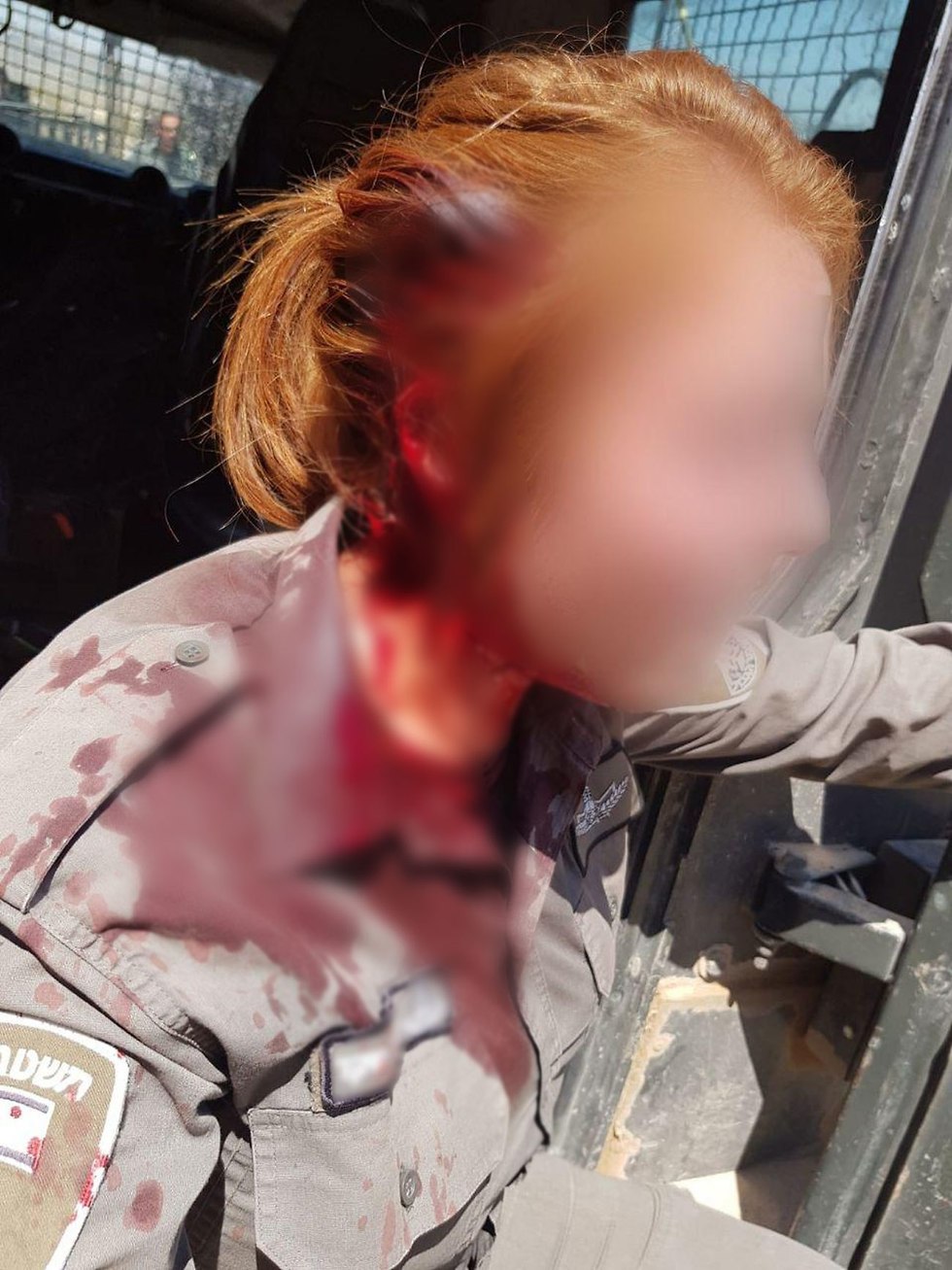 Injured female soldier (Photo: Police Spokesperson)