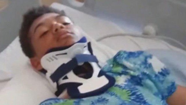 נער נפגע מברק באריזונה שבארצות הברית (צילום: ABC NEWS)
