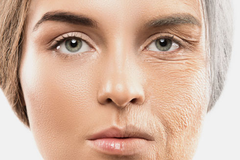 העור באזור העיניים והעפעפיים דק ועדין במיוחד, ומכאן הרגישות הגבוהה לסימני הזדקנות ועייפות (צילום: Shutterstock)
