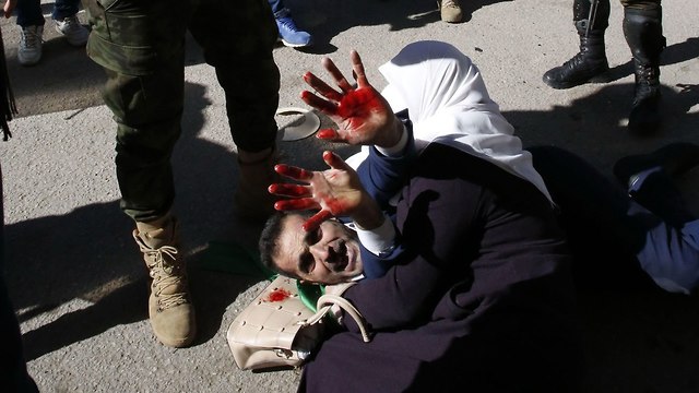 Hamas protester bleeding after being struck by a baton (Photo: AFP)