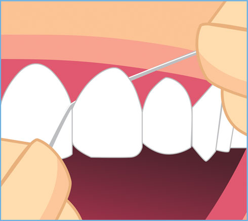 קבעו תור לרופא השיניים שלכם או לשיננית ובקשו הדרכה על שימוש נכון  (איור: Shutterstock)