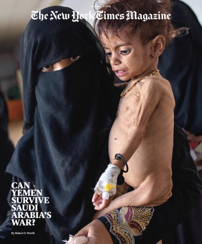 האם תימן תשרוד את המלחמה של סעודיה? צילומה של מרינה חמדאן עם בתה ג'נה בת השנתיים, במרפאה בסעדה שבצפון תימן, הפך לסמל המלחמה העקובה מדם בתימן / נובמבר 2018, צילום: lynsey addario