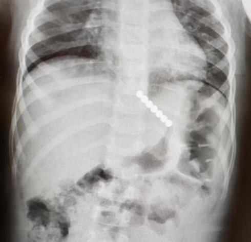 Пресс-служба больницы 