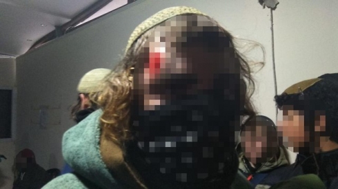 צילום: נוער עמונה