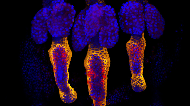 אוכלוסיות תאי גזע של זקיק השערה. אימונופלורסנציה של אוכלוסיות המסומנות על ידי CD34  (אדום) וקרטין 15 (כתום) (צילום  ניצן זוהר, דוברות הטכניון)