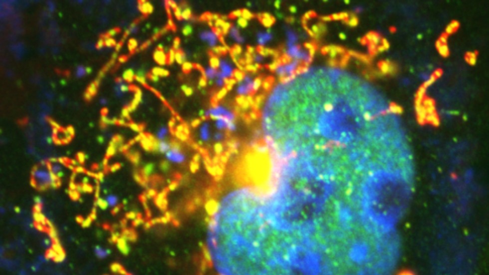 תמונת מיקרוסקופ של תא חי אחד ובו החלבון  (ARTS) ארטס מסומן בצבען פלורסצנטי ירוק/צהוב ממוקם על פני המיטוכונדריה (אדום). בכחול- גרעין התא ()