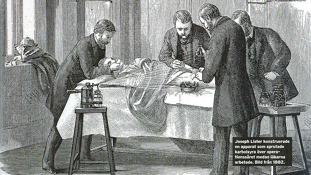 איור של ניתוח באותה תקופה (צילום: ויקיפדיה)