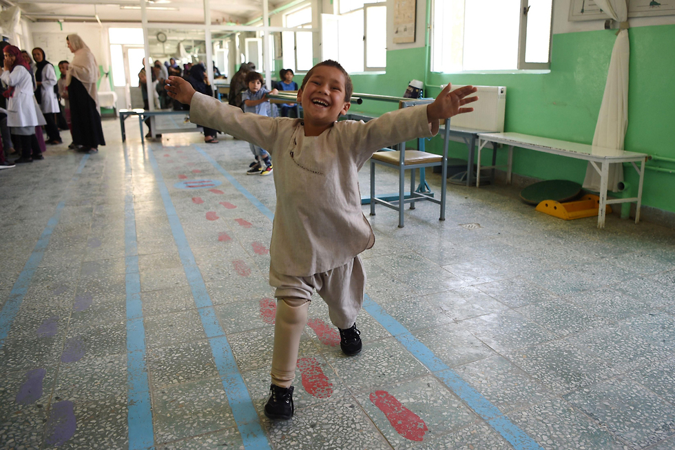 אחמד ילד מ אפגניסטן רוקד עם רגל תותבת (צילום: AFP)