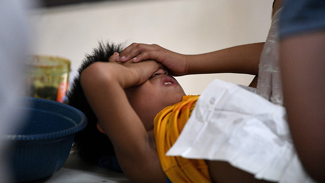 הפיליפינים ילדים פיליפינים בניתוח מילה  (צילום: AFP)