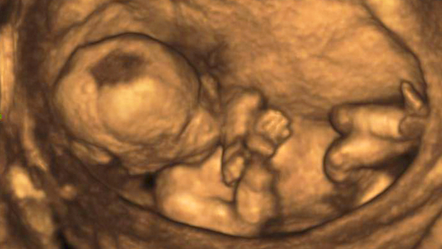 בדיקת אולטרסאונד ובה רואים תינוק בבטן (צילום: shutterstock)