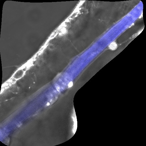 השלד בכחול בתוך הזרוע של הלרווה (צילום: צוות המחקר, אוניברסיטת חיפה)