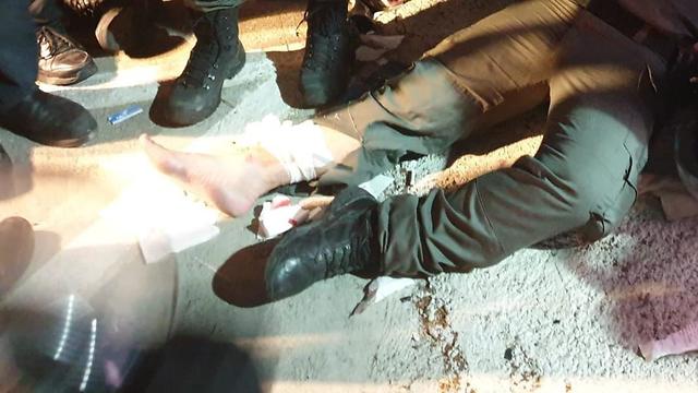 פציעת שוטר בעקבות ההפגנות (צילום: דוברות המשטרה)