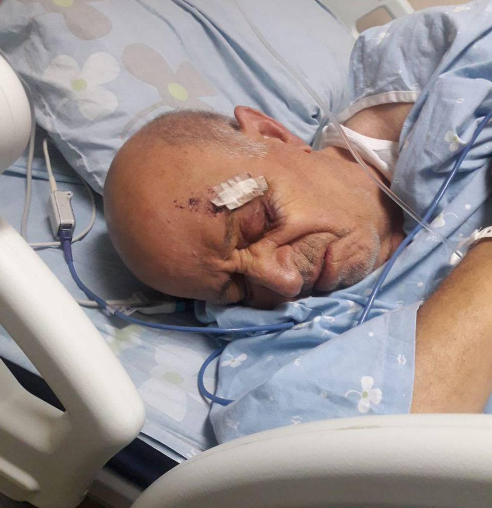 תקיפה פתח תקווה יוסף נגר נהג מונית בן 78 הותקף אישפוז פצועה ()