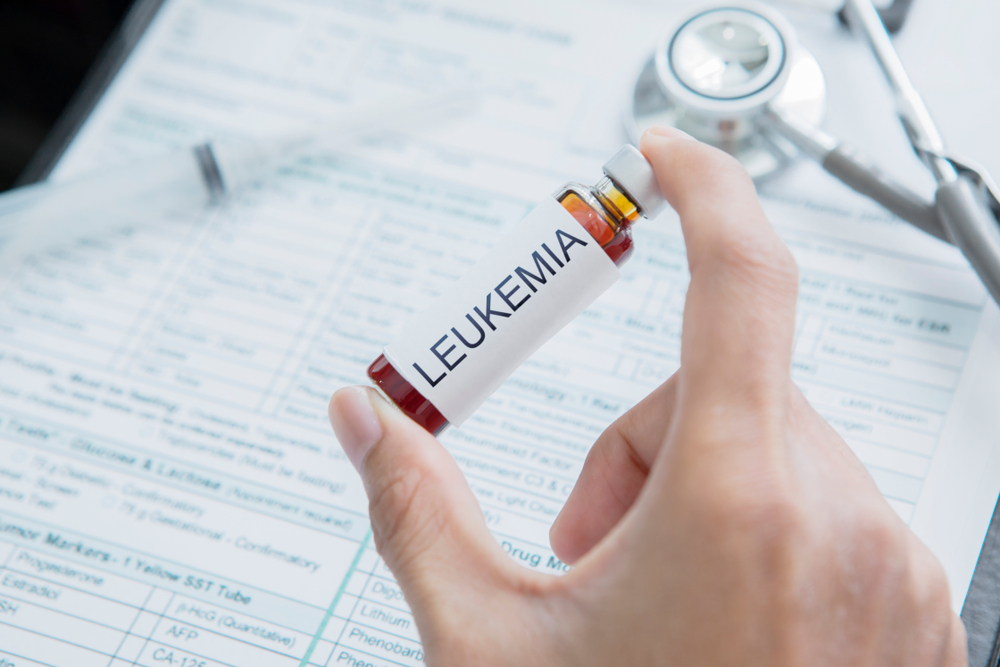 Фото: shutterstock