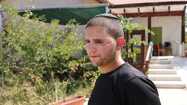 שלוש שנים אחרי פצוע הפיגוע כלוא בביתו לאחר שלא קיבל סיוע ממשרד הביטחון  