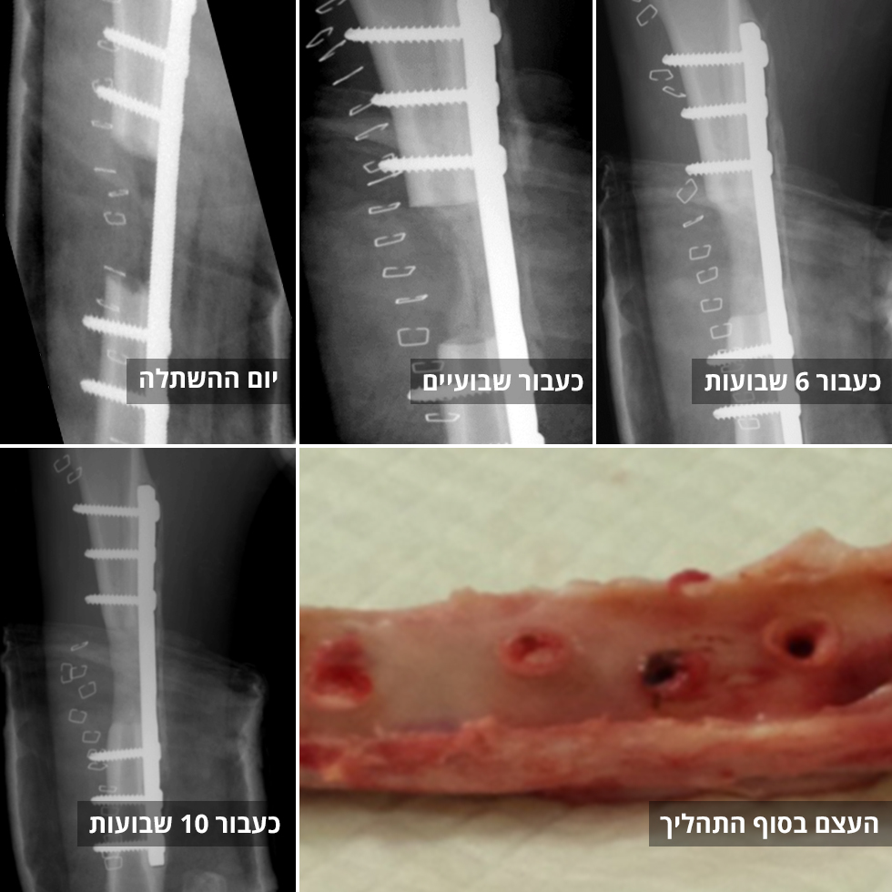 Рентгеновские снимки показывают рост кости из жировых клеток. Слева направо: в день пересадки, через 1, 6, 10 недель и в конце процесса