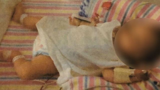ילדה תינוקת ש הורעבה ב דיאטה טבעונית טבעונים סידני אוסטרליה ()