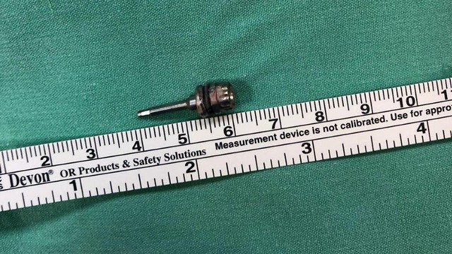 Ключ для имплантов, извлеченный из легких женщины. Фото: пресс-служба больницы "Зив"