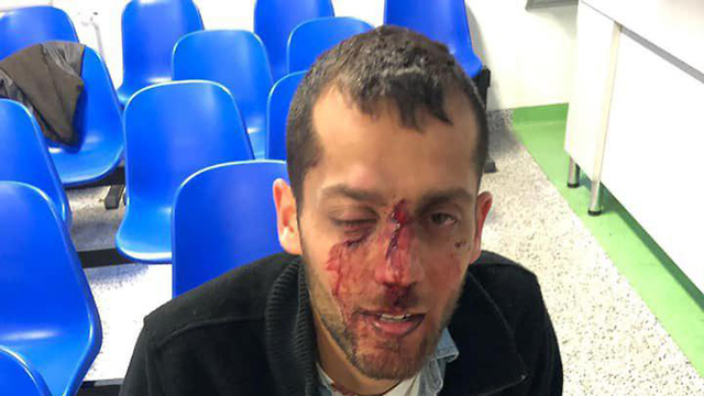 Yotam was attacked on saturday in Warsaw (Photo: Barak Kashpizki)
