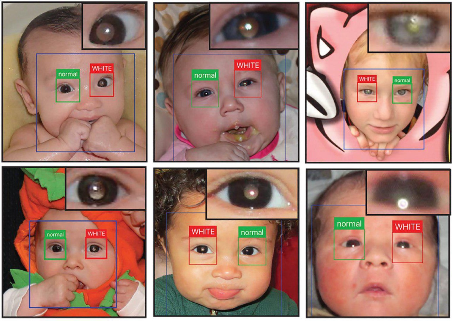  Проблемы зрения, которые можно обнаружить на фотографии с помощью нового приложения
