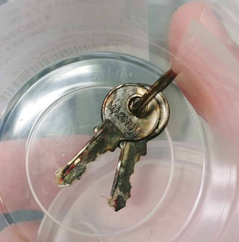 Ключи, которые проглотил 10-месячный мальчик. Фото: пресс-служба больницы "Шаарей-Цедек"