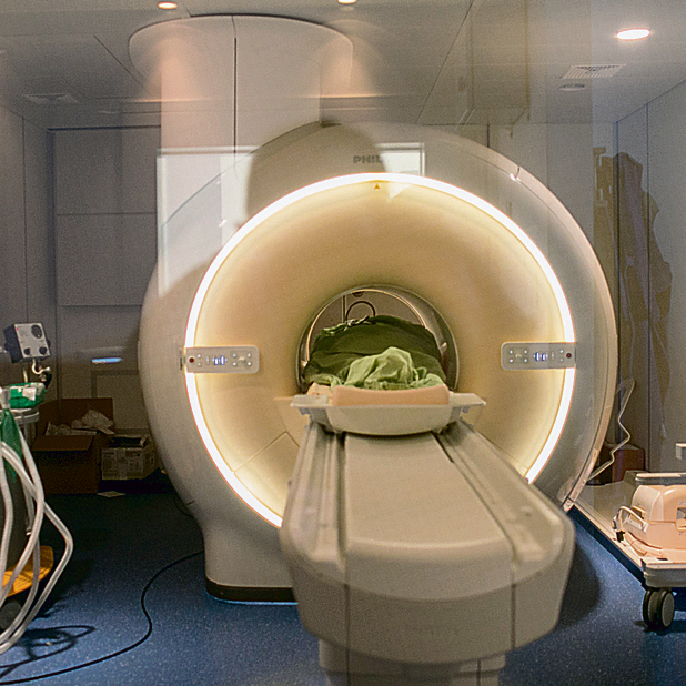 מכשיר MRI . שיעור המכשירים לאוכלוסייה הרבה מתחת לממוצע של מדינות ה־OECD | צילום: אוהד צויגנברג