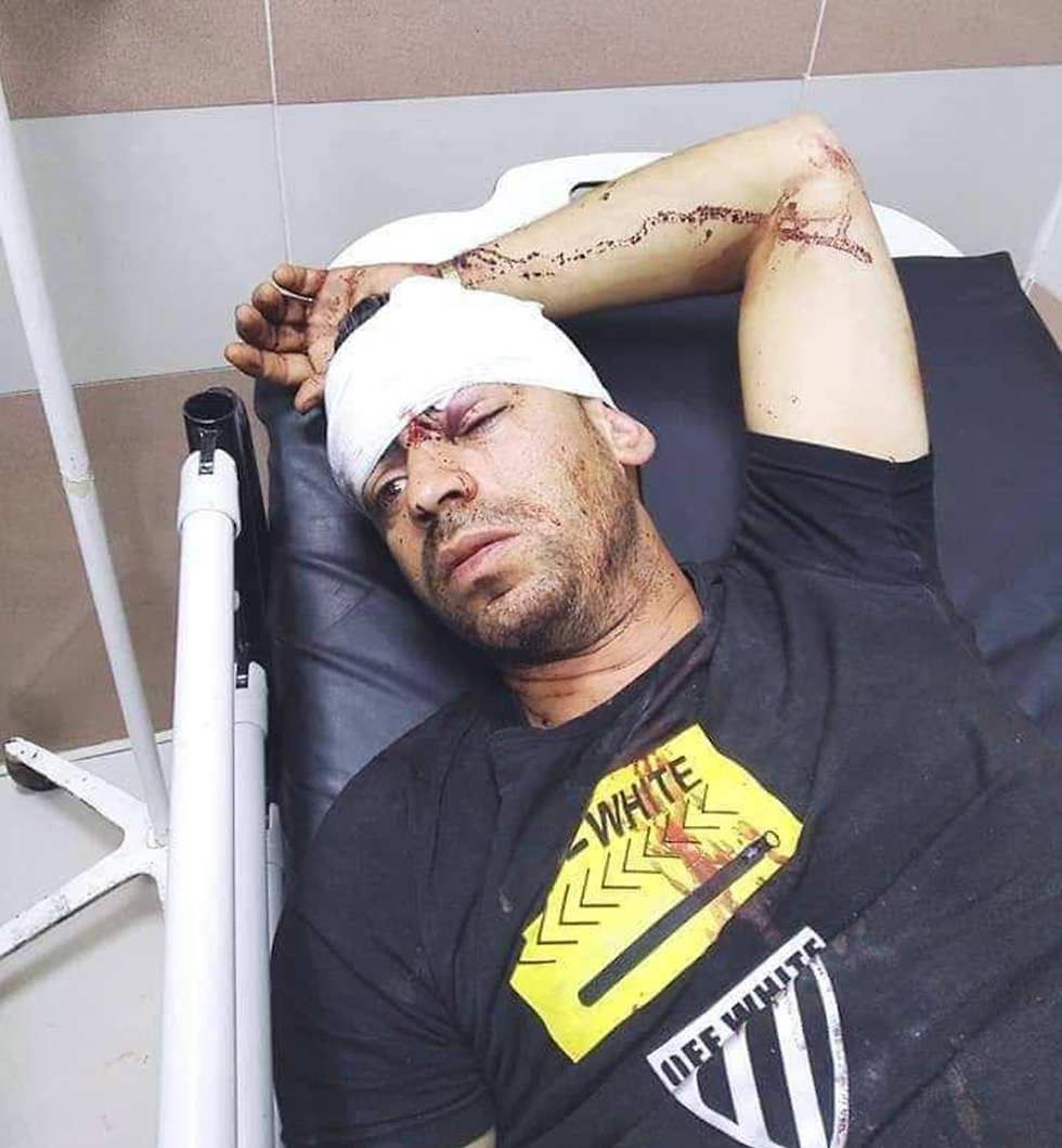 מוהנד קוואריק אשר נפצע מאבן שנזרקה עליו מרכב בעל לוחית ישראלית ()