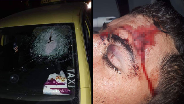 מוהנד קוואריק אשר נפצע מאבן שנזרקה עליו מרכב בעל לוחית ישראלית ()