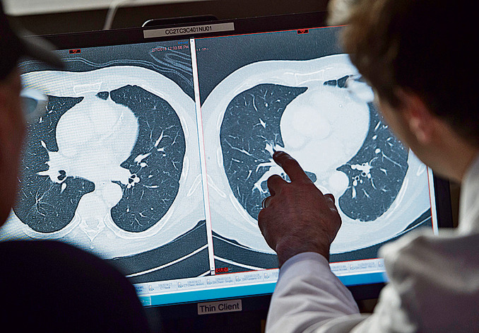 רופא וחולי סרטן בוחנים תצלומי סי־טי של הגידול לפני ואחרי טיפול נסיוני, במכון הבריאות בבתסדה, מרילנד | צילום: AFP