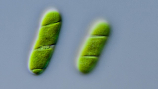 אצות מהמין Spirogloea muscicola שככל הנראה קיבלו מחיידקים גנים לחיי יבשה  (צילום:  Barbara and Michael Melkonian)