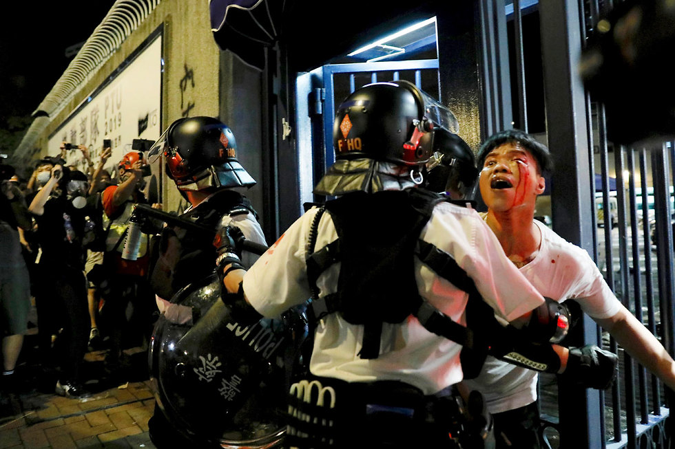 תמונות השנה AP מפגין מדמם מול שוטר מחאה ב הונג קונג (צילום: AP)