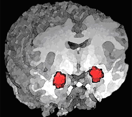 האמיגדלה (באדום) – מבנה מוחי דמוי שקד הנמצא בעומק האונה הרקתית של יונקים רבים, ובהם האדם. מעורבת בתהליכי למידה אסוציאטיבית שבהם נוצרת זיקה בין קלט חושי מסוים לחוויות חיוביות או שליליות (צילום: מסע הקסם המדעי, מכון ויצמן)